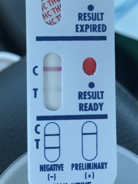 2 years of direct patient care as a RN. . United health group drug test reddit